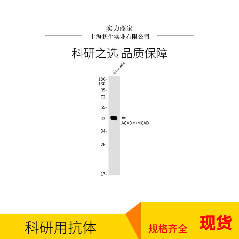 瞬时受体电位离子通道蛋白6抗体,TRPC6 Rabbit pAb