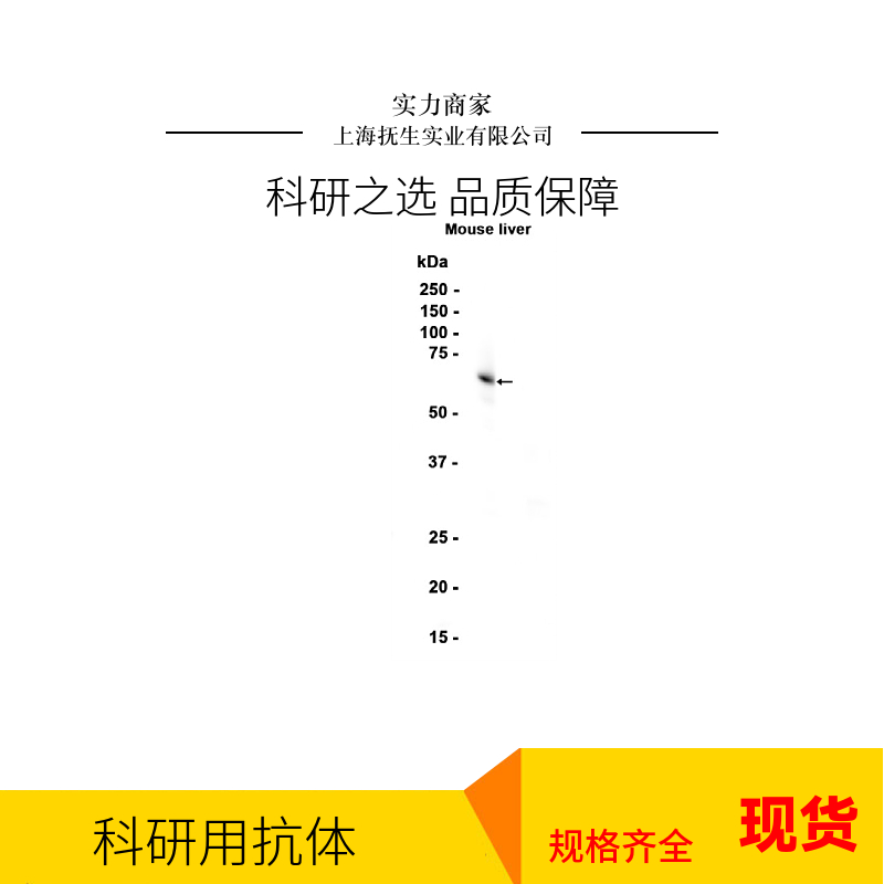 细胞信号转导分子SMAD3单克隆抗体,Smad3 Mouse mAb
