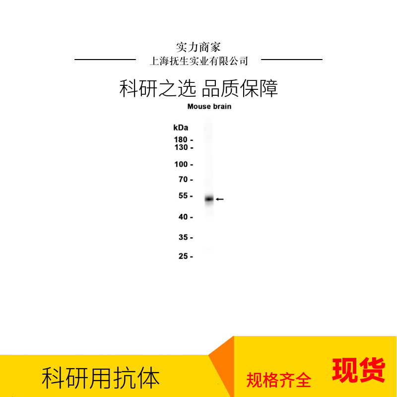 信号通路Wnt5a抗体,WNT5A Rabbit pAb