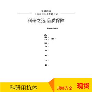肾损伤分子1/甲型肝炎病毒细胞受体1抗体