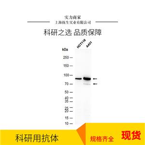 细胞凋亡诱导蛋白NALP3抗体,NALP3/CIAS1 Rabbit pAb
