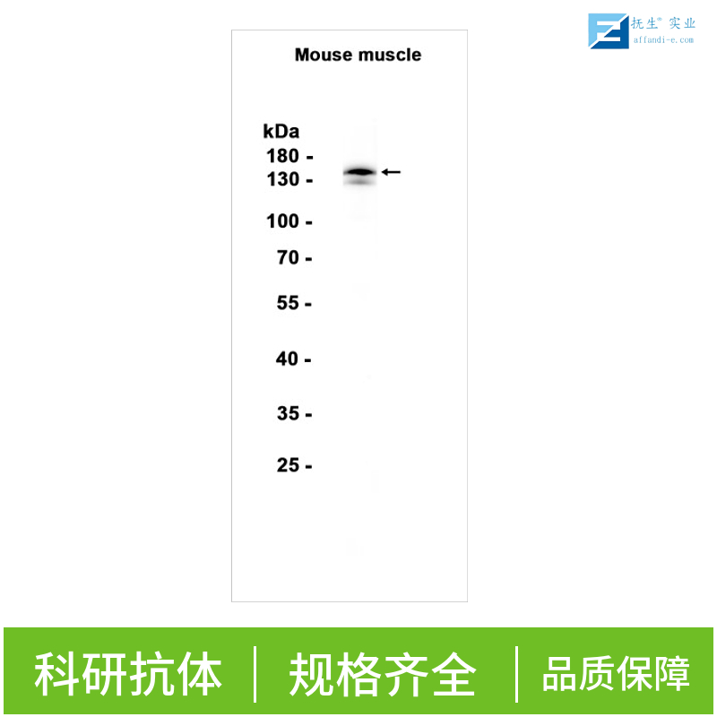 乙酰胆碱酯酶抗体,ACHE Rabbit pAb
