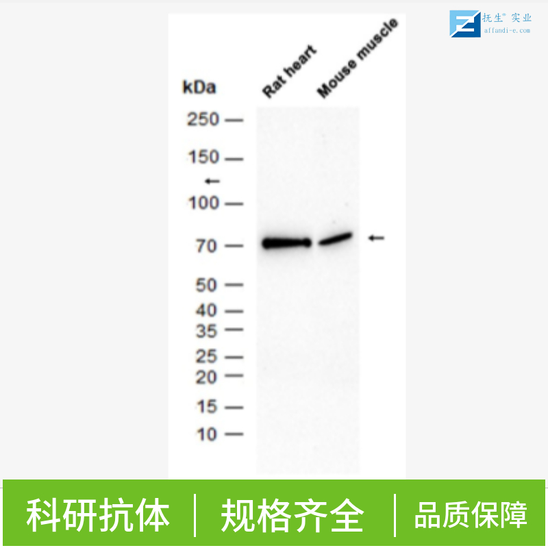 一氧化氮合成酶-3（内皮型）单克隆抗体,eNOS Mouse mAb