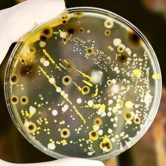 Faecalibacillus Intestinalis,Faecalibacillus Intestinalis