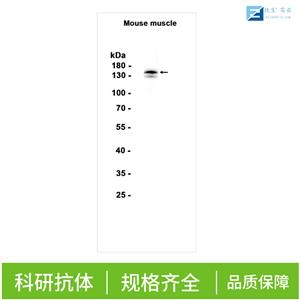 乙酰胆碱酯酶抗体,ACHE Rabbit pAb