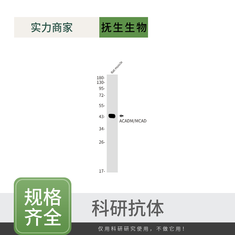 载脂蛋白E2受体抗体,ApoER2 Rabbit pAb