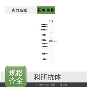 原癌基因蛋白/活化蛋白1抗体