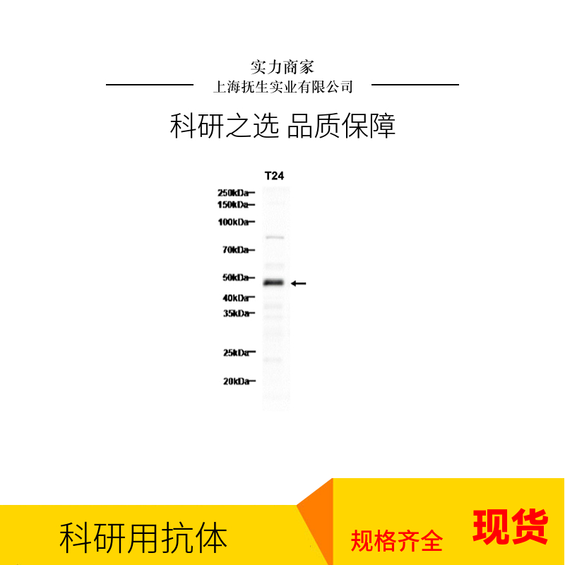 卵巢癌抗原单克隆抗体,MUC16 Mouse mAb