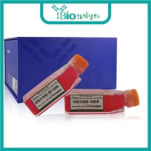 人卵巢癌组织源细胞 YB-7127HPC,Human Ovarian Cancer Tissue-Derived Cells