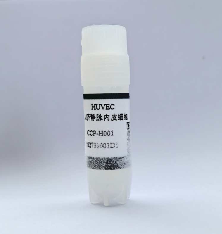 人脐静脉内皮细胞,Human Umbilical Vein Endothelial Cells(HUVEC)