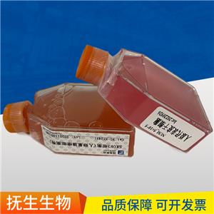 h9 Feeder Frec人胚胎干细胞H9   (WA09)