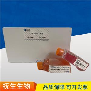 MDA-MB-231人乳腺癌细胞,MDAMB231:MDA-MB-231