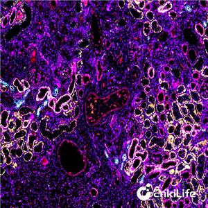 TSA六标七色多重荧光染色试剂盒（mIHC）,7-Color Multiple Fluorescent Staining Kit (mIHC)