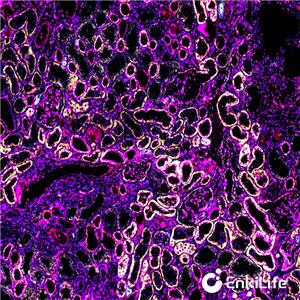 TSA六标七色多重荧光染色试剂盒（mIHC）,7-Color Multiple Fluorescent Staining Kit (mIHC)
