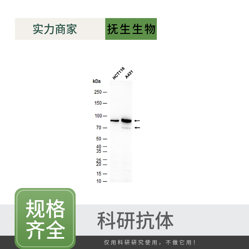 磷酸化糖原合酶激酶-3β抗体,phospho-GSK-3 Beta (Ser9) Rabbit pAb