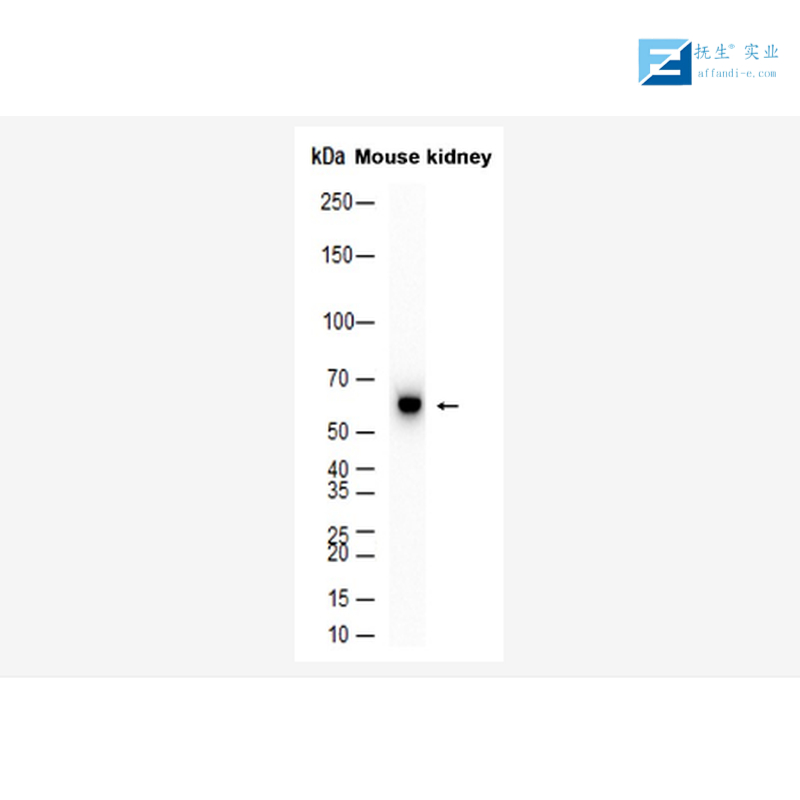 磷酸化糖原合酶激酶3β抗体,phospho-GSK3 Beta (Tyr216) Rabbit pAb