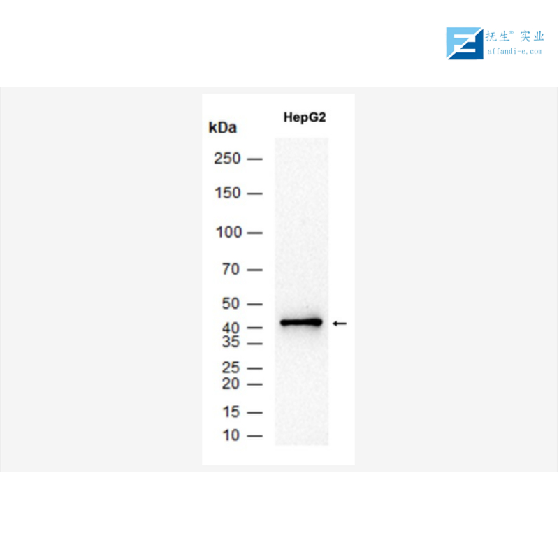 磷酸化丝氨酸/苏氨酸抗体,Phospho-Serine/Threonine Rabbit pAb