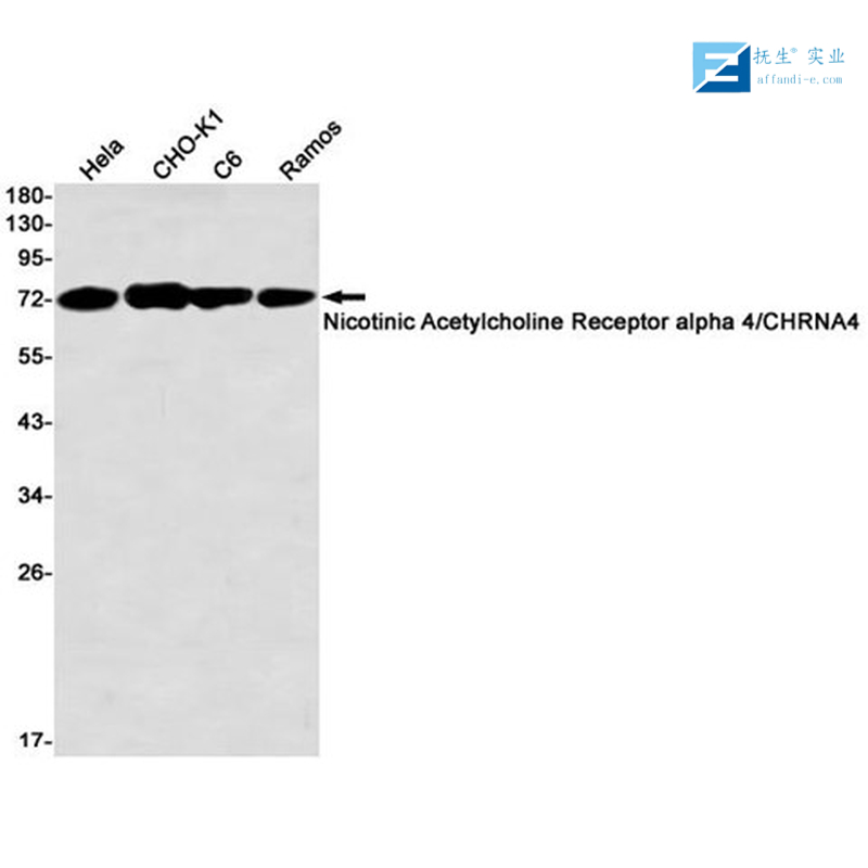 磷酸化水通道蛋白2抗体,phospho-AQP2 (Ser256) Rabbit pAb