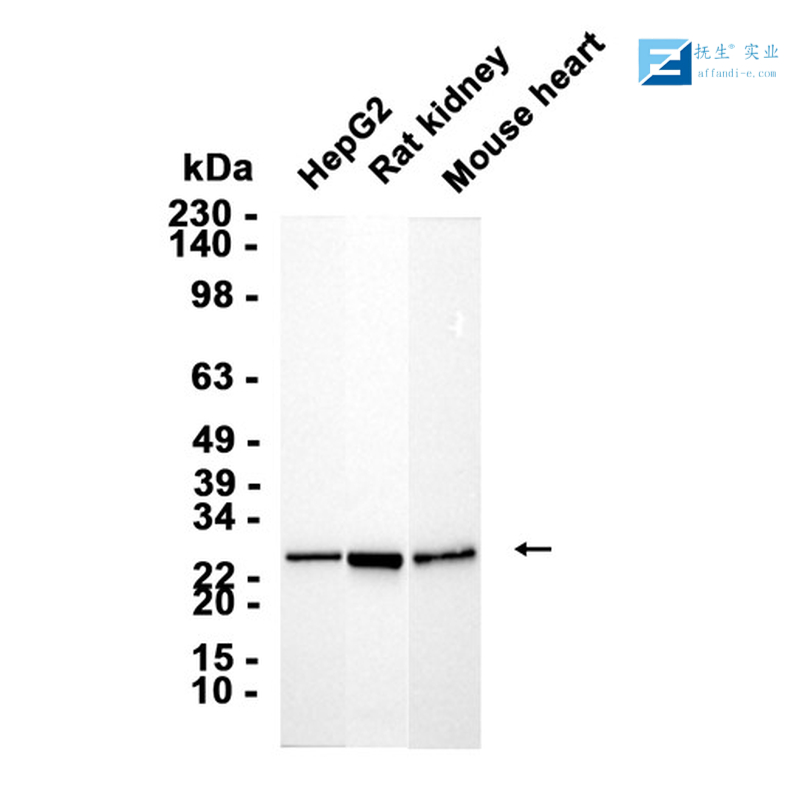 磷酸化三羟基三甲基辅酶A还原酶抗体,phospho-HMGCR (Ser872) Rabbit pAb