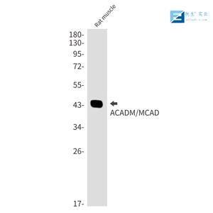 磷酸化内质网核信号转导蛋白a1抗体,phospho-IRE1a (Ser 726) Rabbit pAb
