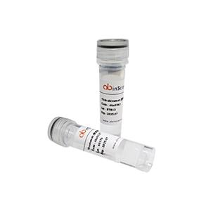 重组美国室尘螨Der f 1蛋白（C端组氨酸标签）,Recombinant American house dust mite Der f 1 Protein, C-His