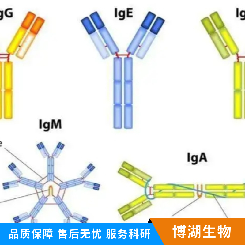 G蛋白偶联受体75抗体,GRP75 Rabbit pAb