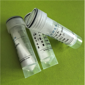 Met氧化修饰肽-Amyloid β-Protein (25-35),(Met(O)35)-Amyloid β-Protein (25-35)