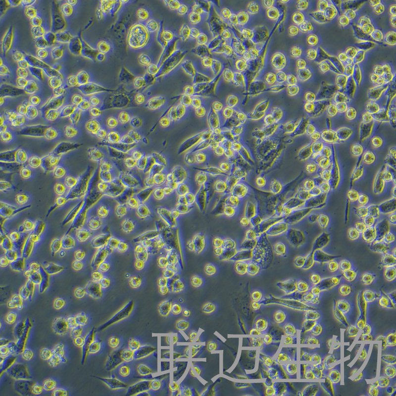 LLC-LUC细胞（小鼠肺癌细胞荧光素酶标记）LM8C0140-L,LLC-LUC