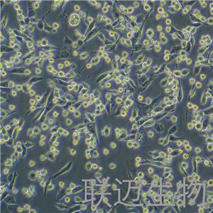 LLC-LUC细胞（小鼠肺癌细胞荧光素酶标记）LM8C0140-L