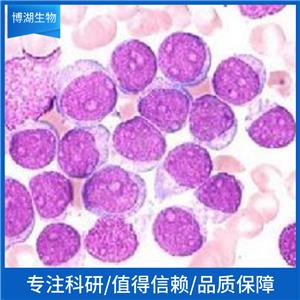 HCC1143人乳腺癌细胞,HCC1143