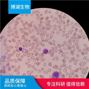 CCD-1069Sk人乳腺浸润性导管癌旁皮肤细胞,CCD-1069Sk