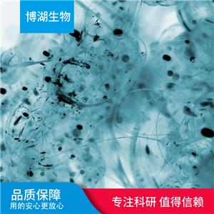 CCD-1069Sk人乳腺浸润性导管癌旁皮肤细胞,CCD-1069Sk