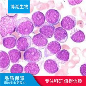 CAL-120人乳腺癌细胞,CAL-120