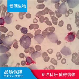 CAL-120人乳腺癌细胞,CAL-120