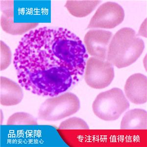 CAL-120人乳腺癌细胞,CAL-120