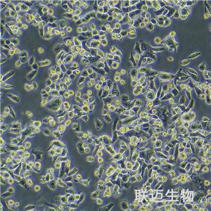 AsPC-1细胞（转移胰腺腺癌细胞STR鉴定正确）LM8C0027