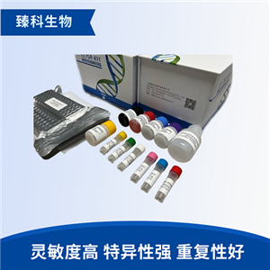 人膀胱肿瘤抗原(BTA）检测试剂盒（ELISA法）