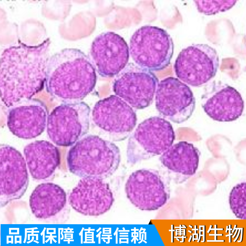 Ca Ski人子宫癌细胞,Ca Ski