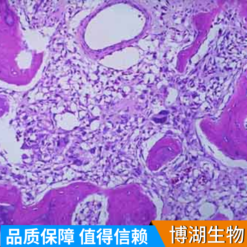 GP2d人结肠癌细胞,GP2d (human colon cancer cells)
