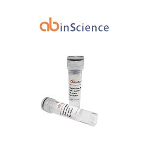 重组欧洲屋尘螨 Der p 1/DERP1 蛋白，N端-His标签,Recombinant European house dust mite Der p 1/DERP1 Protein, N-His