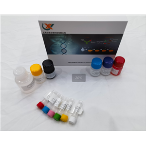 兔氧化低密度脂蛋白（OxLDL）elisa试剂盒