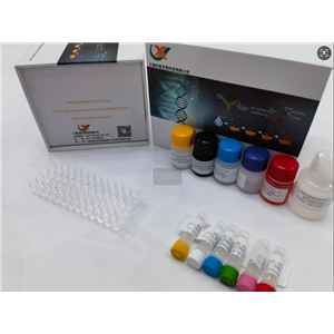 兔氧化低密度脂蛋白（OxLDL）elisa试剂盒