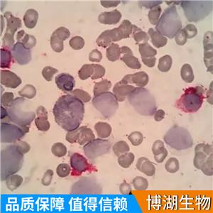 HuNS1人多发性骨髓瘤细胞,Human multiple myeloma cells (MM.1S)