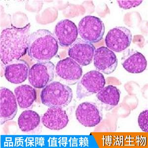 MDST8人结肠癌细胞,MDST8