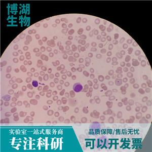 M14人黑色素瘤细胞,M14