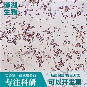 M14人黑色素瘤细胞,M14