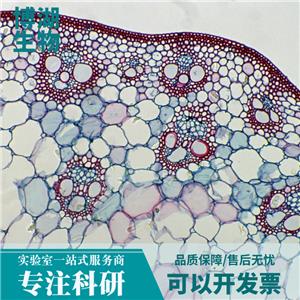 M14人黑色素瘤细胞,M14