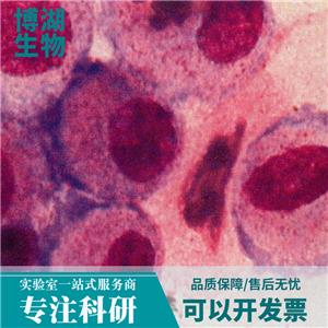 M14人黑色素瘤细胞,M14