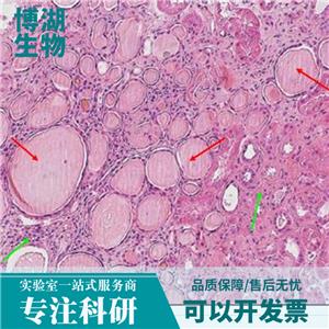 HuNS1人多发性骨髓瘤细胞,Human multiple myeloma cells (MM.1S)