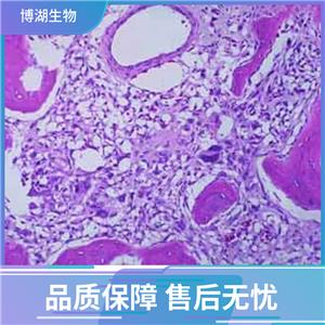 HuNS1人多发性骨髓瘤细胞,Human multiple myeloma cells (MM.1S)